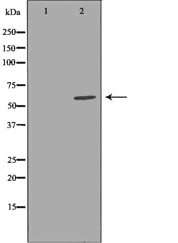 CBS Antibody