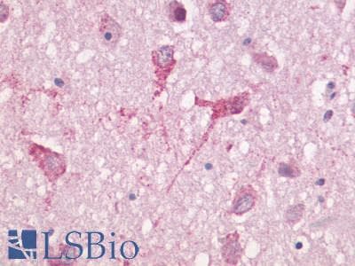 PathPlus™ Polyclonal Rabbit anti-Human GPR83 Antibody (Cytoplasmic Domain, IHC)