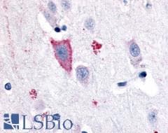 PathPlus™ GPR35 Antibody (C-Terminus)