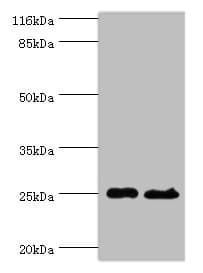 Polyclonal Rabbit anti-Human TESC Antibody (aa2-214, WB)
