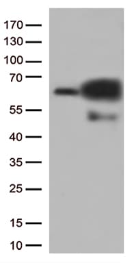 PRCC / RCCP1 Antibody (aa135-491, clone OTI5H7, Carrier-free)