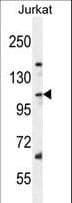 Polyclonal Rabbit anti-Human SNX25 Antibody (aa399-426, WB)