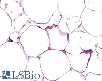 IHC-plus™ VIPR1 Antibody (Cytoplasmic Domain)
