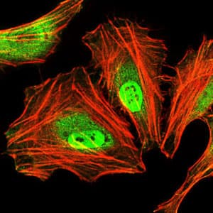 Monoclonal Mouse anti-Human C/EBP Alpha / CEBPA Antibody (clone 5B7, IHC, IF, WB)