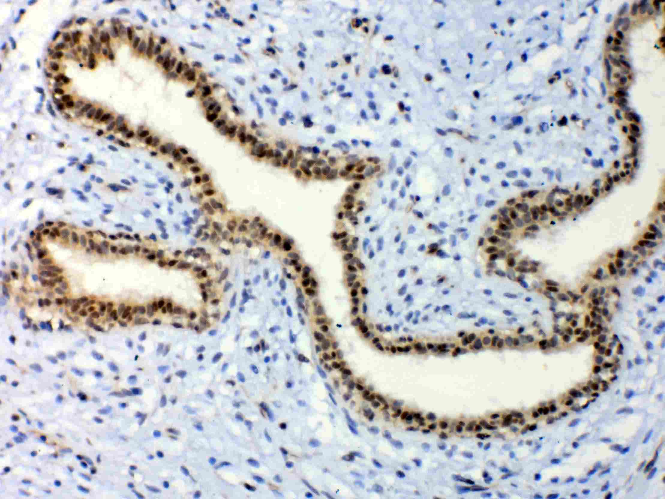 Polyclonal Rabbit anti-Human ETV6 / TEL Antibody (IHC, WB)