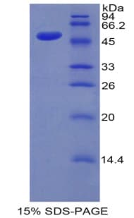 Mouse KLK7 / Kallikrein 7 Protein (Recombinant His-GST)