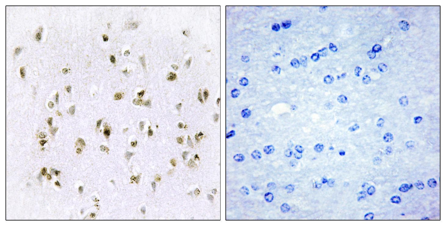 Polyclonal Rabbit anti-Human HMGN2 Antibody (IHC, IF)