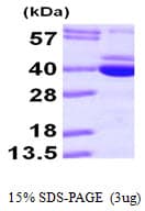 Human PDXK / PNK Protein (Recombinant His)