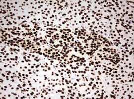 Monoclonal Mouse anti-Human HNRPM / HNRNPM Antibody (clone OTI3F3, aa1-261, IHC, WB)