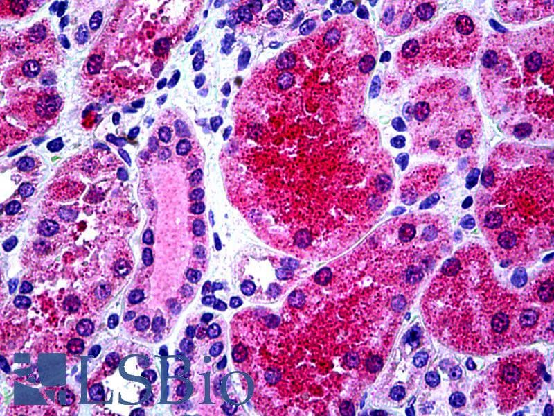 IHC-plus™ Polyclonal Goat anti-Human KCNN4 / KCa3.1 Antibody (aa227-239, IHC, IF, WB)