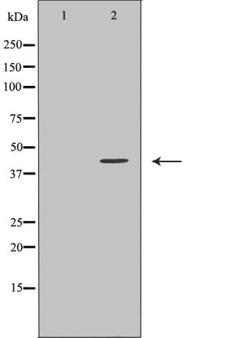 PSMD4 / RPN10 Antibody