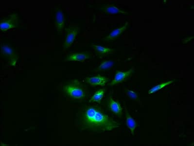 Polyclonal Rabbit anti-Human RNF133 Antibody (IHC, WB)