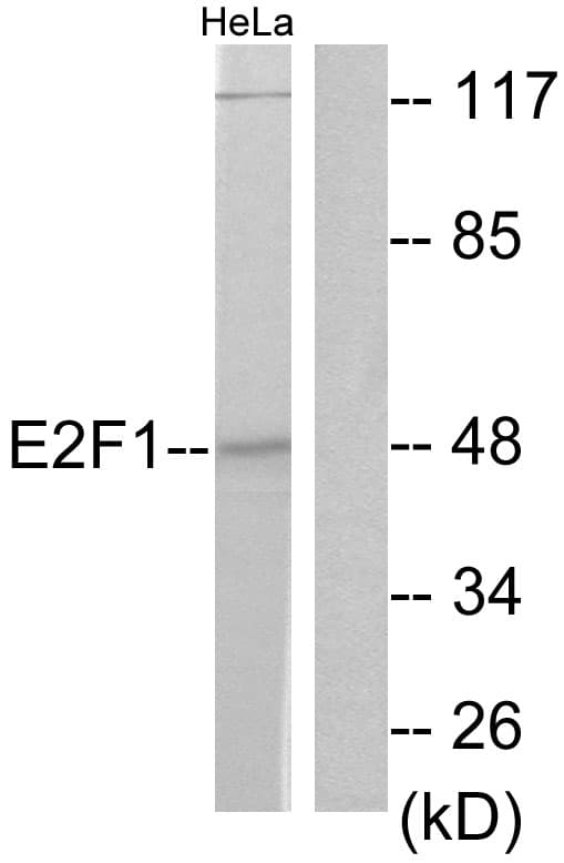 E2F1 Antibody (aa388-437)