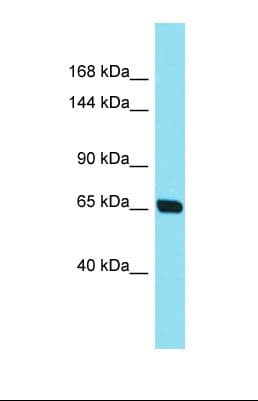 CEP104 Antibody (aa79-128)