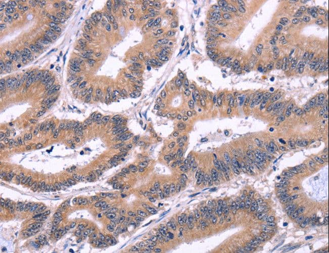EFNA5 / Ephrin A5 Antibody