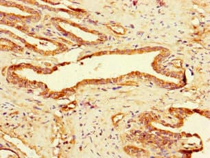 GAA / Alpha-Glucosidase, Acid Antibody (aa601-952)