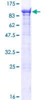 Human KIF1BP Protein (Recombinant GST)