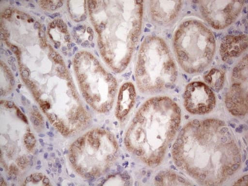 Monoclonal Mouse anti-Human RORB / ROR Beta Antibody (clone OTI1G1, aa1-260, IHC, WB)