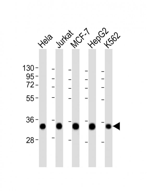 Polyclonal Rabbit anti-Human HNRNPA1L2 Antibody (aa22-56, IHC, WB)