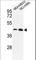 KLF4 Antibody (Ser457)