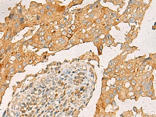 CXCL1 / GRO Alpha Antibody