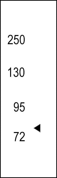 IHC-plus™ Polyclonal Rabbit anti-Human NTRK3 / TRKC Antibody (aa31-61, IHC, WB)