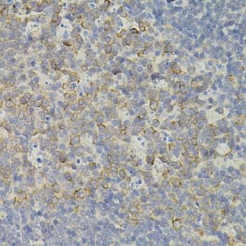 IRF1 / MAR Antibody