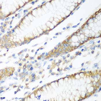 Polyclonal Rabbit anti-Human PTEN Antibody (IHC, WB)