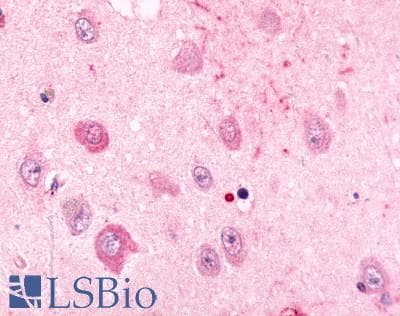 PathPlus™ ADRA2C Antibody (Extracellular Domain)