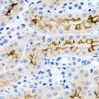Polyclonal Rabbit anti-Human BAIAP2 / IRSP53 Antibody (IHC, IF, WB)