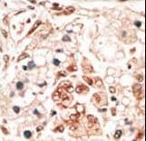 Polyclonal Rabbit anti-Human HPCA / Hippocalcin Antibody (aa2-32, IHC, WB)