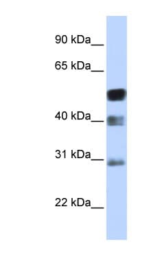 TFAP2B / AP2 Beta Antibody (aa35-84)