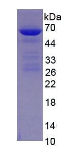 Human ALB / Serum Albumin Protein (Recombinant His, N-Terminal)