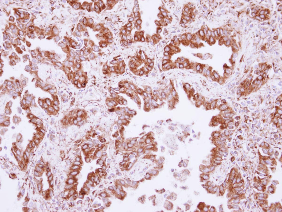 NUDCD1 Antibody