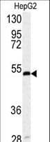 SERPINH1 / HSP47 Antibody (aa169-196)