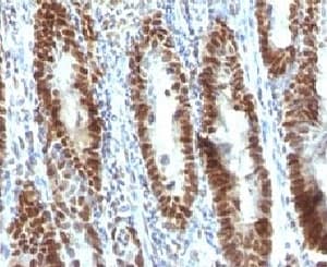 TNRC9 / TOX3 Antibody (aa200-400, clone TOX3/1123)