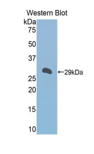 A1BG Antibody (aa220-415, HRP)