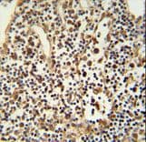 Polyclonal Rabbit anti-Human ANO5 / Anoctamin 5 Antibody (aa792-819, IHC, WB)