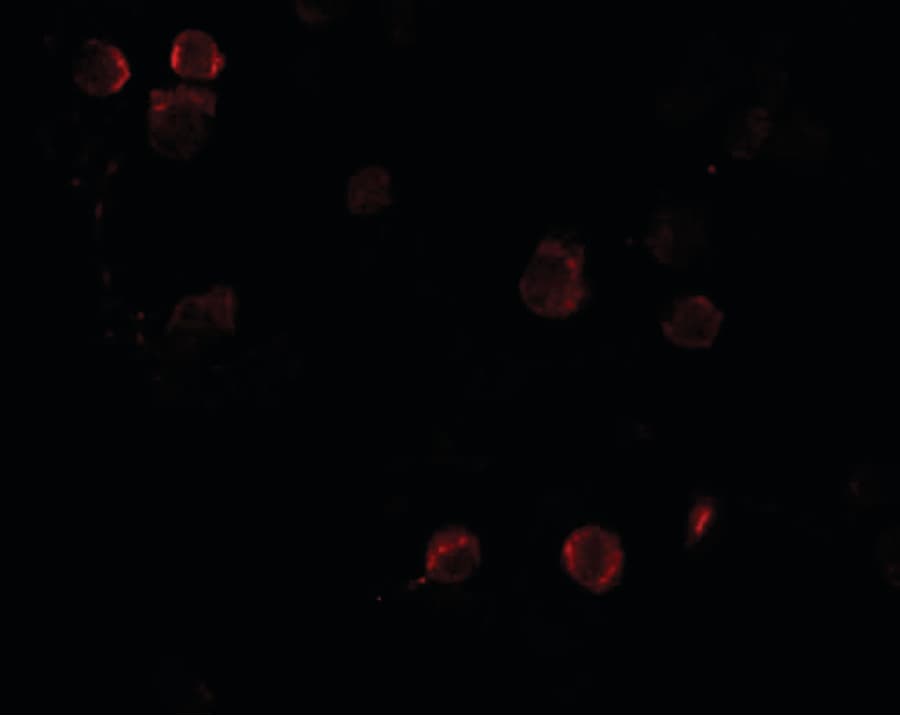 IHC-plus™ FREM1 Antibody