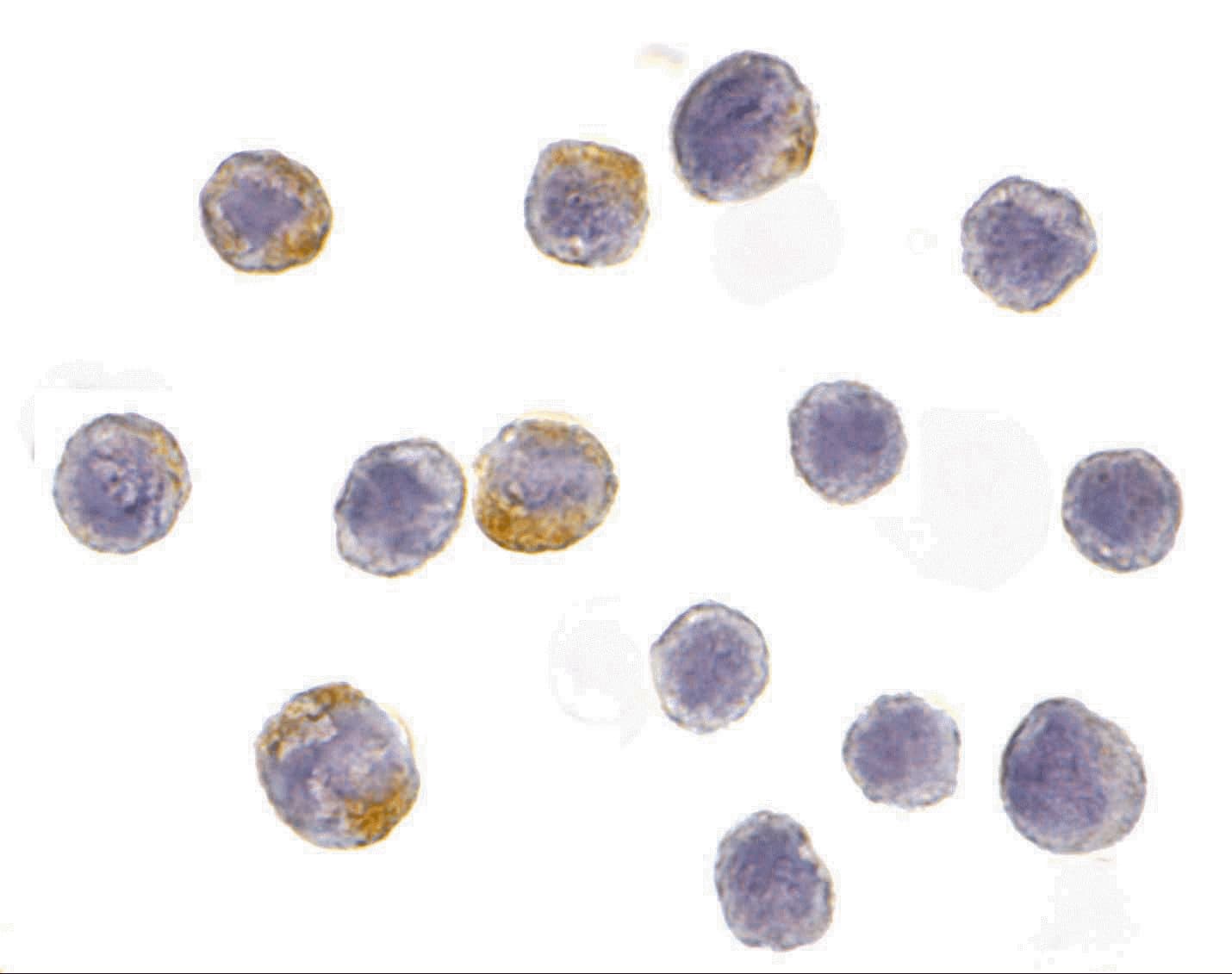 Polyclonal Rabbit anti-Human CHUK / IKKA / IKK Alpha Antibody (IF, WB)