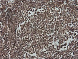 PIK3R5 Antibody (clone OTI2C6)