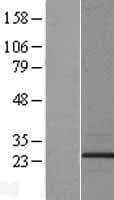 TMEM17 Protein (Over-Expression Lysate Myc-DDK (Flag))