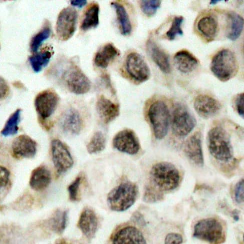 HDAC8 Antibody (phospho-Ser39)
