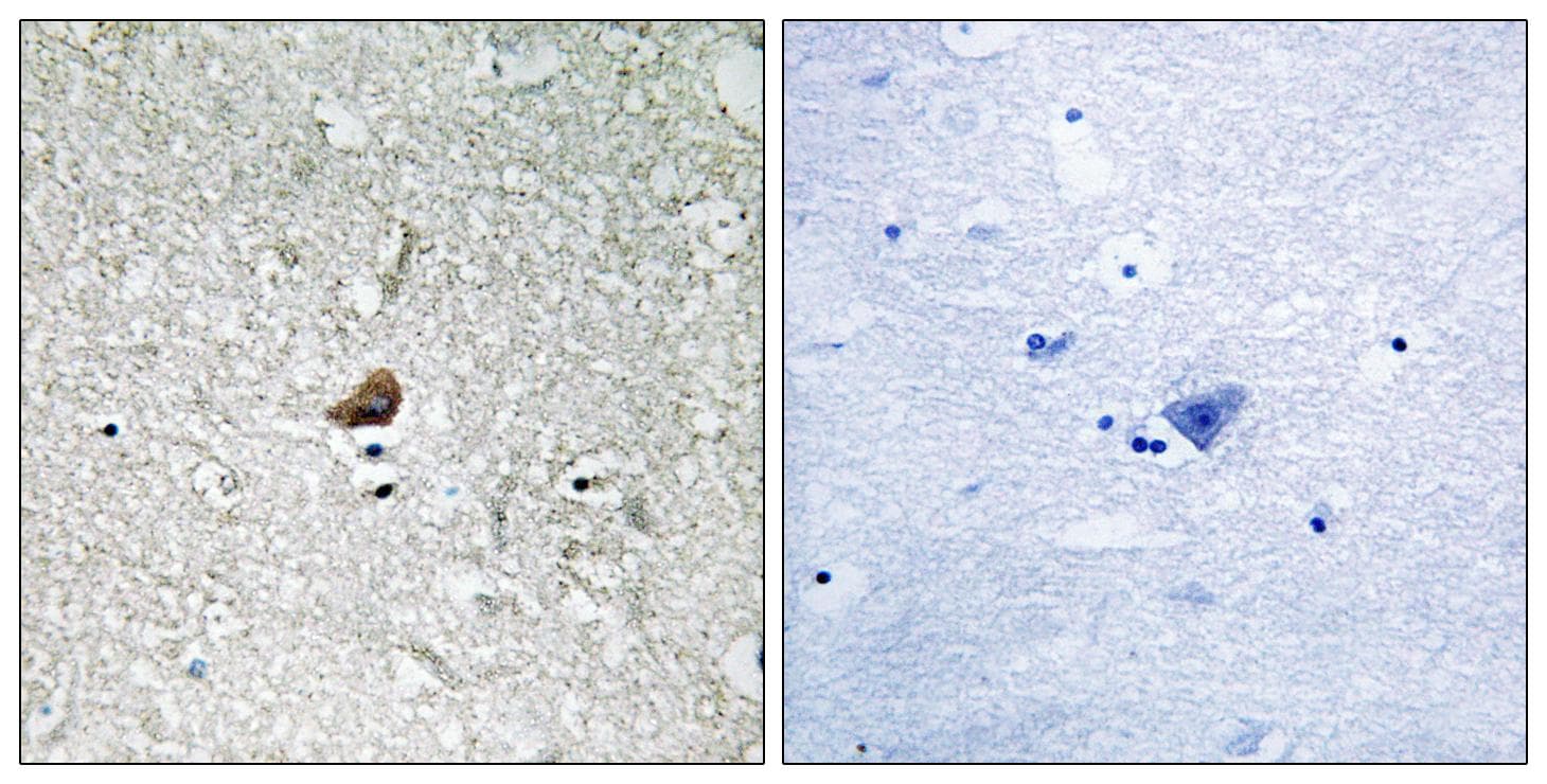 IRAK1 / IRAK Antibody (Ab-376)