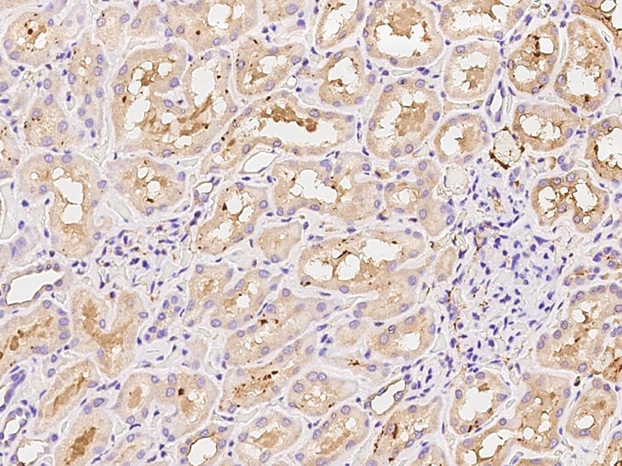 Polyclonal Rabbit anti-Human FABP3 / H-FABP Antibody (IHC)