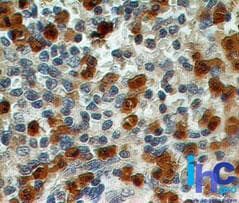S100A8 / MRP8 Antibody (aa2-105, clone 48M7C7)