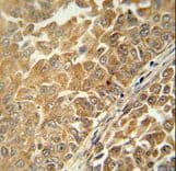 Polyclonal Rabbit anti-Human C18orf25 / ARKL1 Antibody (aa163-191, IHC, WB)