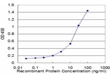 TAC3 / Tachykinin Antibody (clone 1B2)