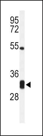 NAR / CPSF4 Antibody (aa96-123)