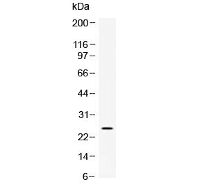 Polyclonal Rabbit anti-Rat VEGFA / VEGF Antibody (WB)